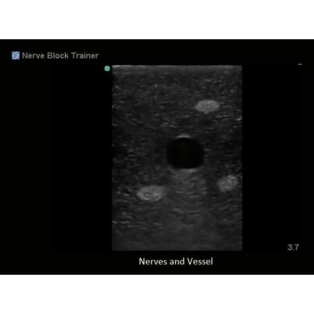 Regional Anesthesia Ultrasound Training Block