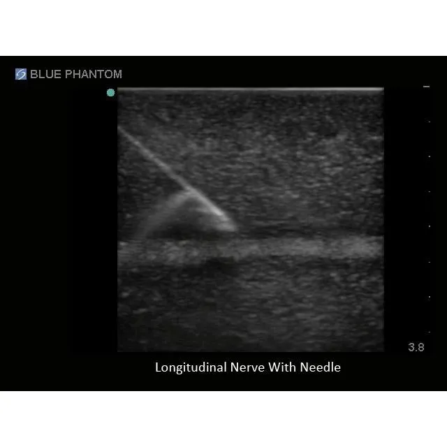 Regional Anesthesia Ultrasound Training Block